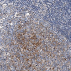 ARPC5L Antibody, Novus Biologicals:Antibodies:Primary Antibodies